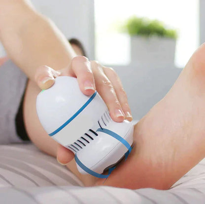 mybeautytime) Vacuum Callus Remover